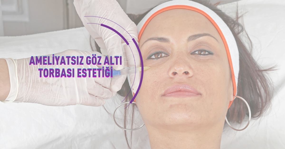 Ameliyatsız Göz Altı Torbası Estetiği