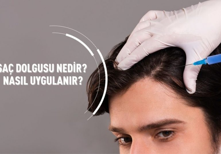 Saç Dolgusu Nedir Nasıl Uygulanır